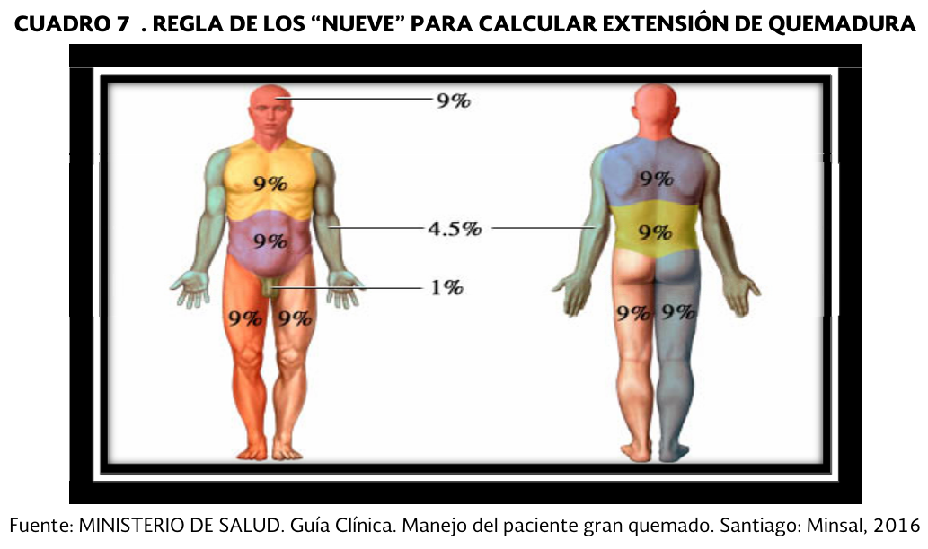 2. Regla de los 9 puntos - GPC-IMSS-375-17